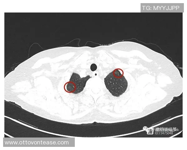 曝米勒因肩伤将寻求第二确诊定见 或考虑经过手术医治